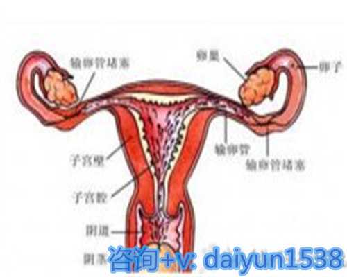 代生代怀费用，去日本做三代试管可以选性别吗，日本加藤女子医院可支持试管选性别